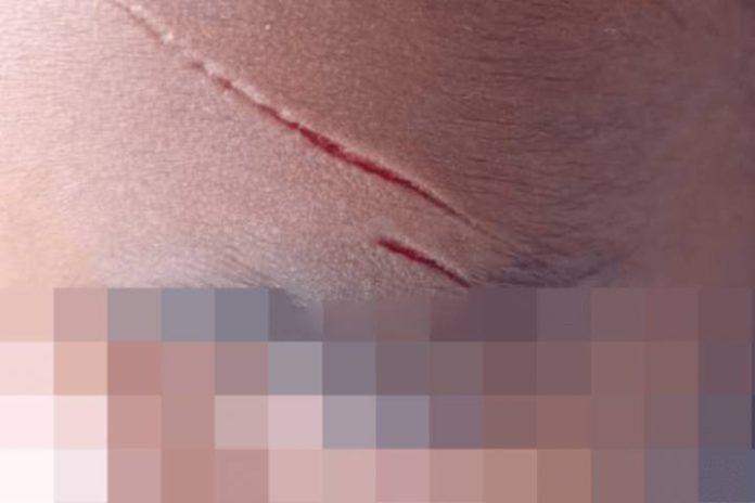 Criança é ferida com estilete dentro de escola em Balneário Piçarras